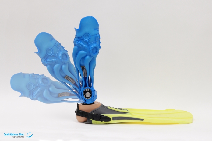 Creating a one-of-a-kind prosthesis with Artec Eva and Geomagic Freeform